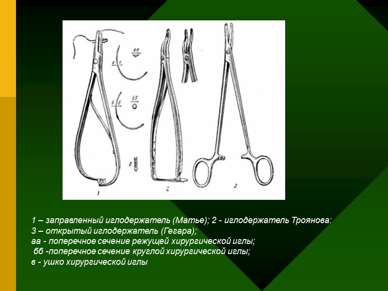 1 – заправленный иглодержатель (Матье); 2 - иглодержатель Троянова: 3 – открытый иглодержатель 1 – заправленный иглодержатель (Матье); 2 - иглодержатель Троянова: 3 – открытый иглодержатель
